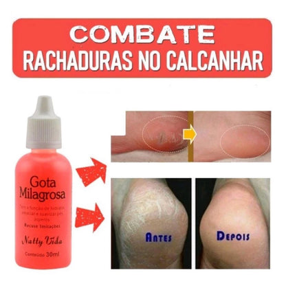 HOJE: COMPRE 1 LEVE 3 - Loção Gota Milagrosa