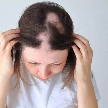 Capillus LaserCare 4 em 1 - Raiz ativa, fio forte.