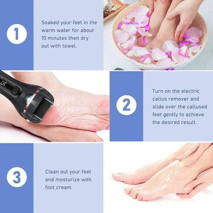 Removedor de Calos Elétrico USB - Pedicure Profissional 2 Velocidades - Sellve