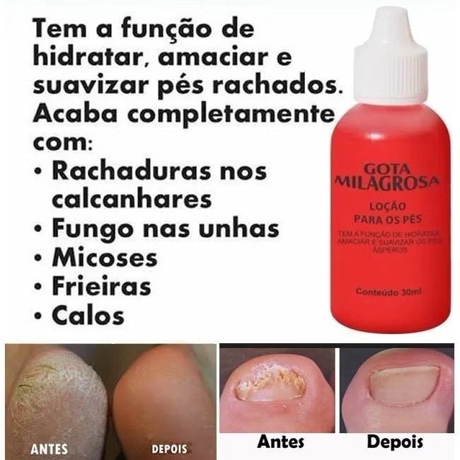 HOJE: COMPRE 1 LEVE 3 - Loção Gota Milagrosa