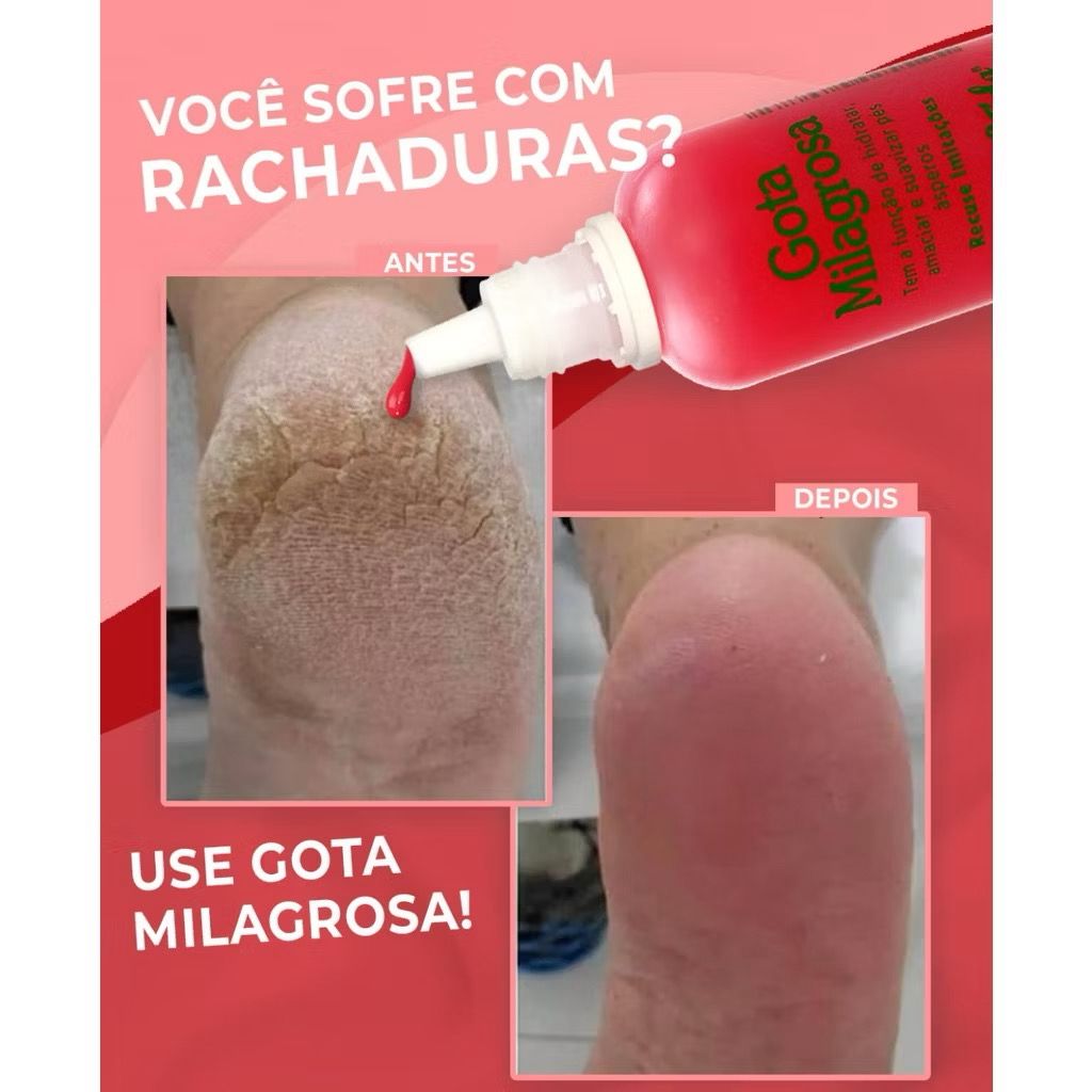 HOJE: COMPRE 1 LEVE 3 - Loção Gota Milagrosa