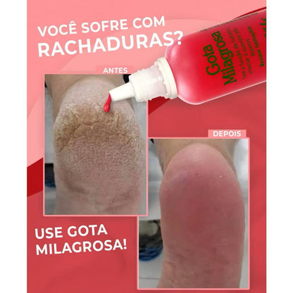 HOJE: COMPRE 1 LEVE 3 - Loção Gota Milagrosa