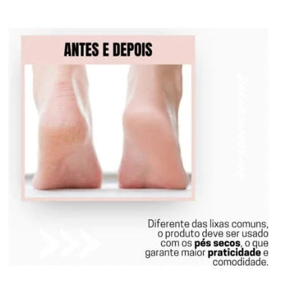 Lixa Elétrica para Pés - Remoção Calos e Pele Morta - Uso Profissional - Sellve