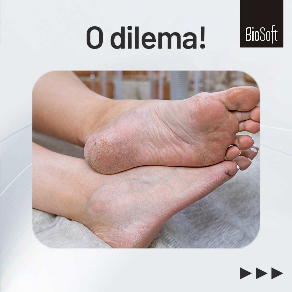 COMPRE 1 LEVE 2: Creme Hidratante Pés 120g - Hidratação Profunda e Dermatológico - Sellve