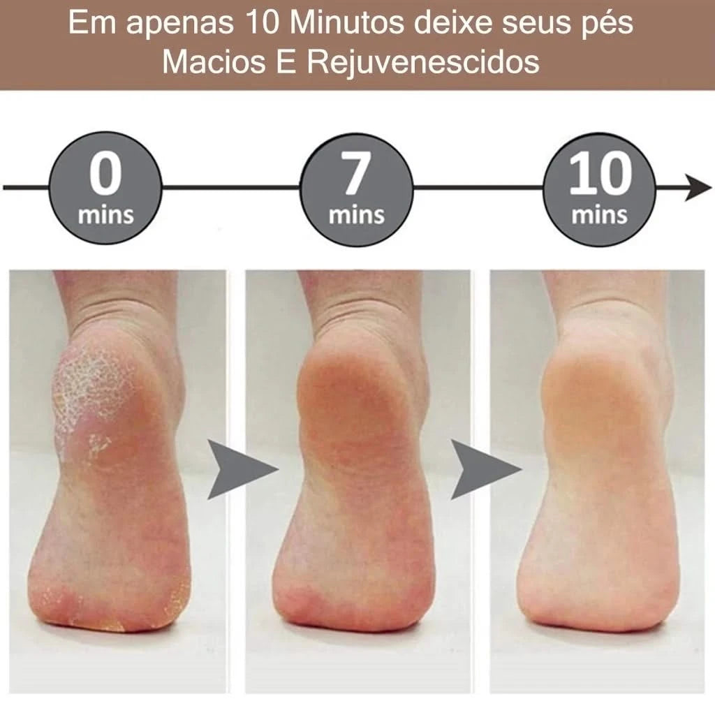 Lixa Elétrica para Pés - Remoção Calos e Pele Morta - Uso Profissional - Sellve