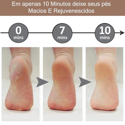 Lixa Elétrica para Pés - Remoção Calos e Pele Morta - Uso Profissional - Sellve