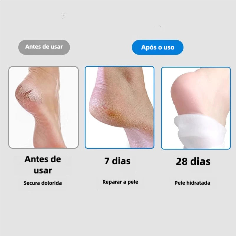 Kit Spa para os Pés HidraFeet™