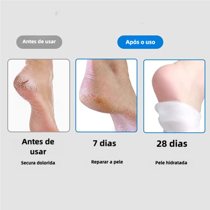 Kit Spa para os Pés HidraFeet™