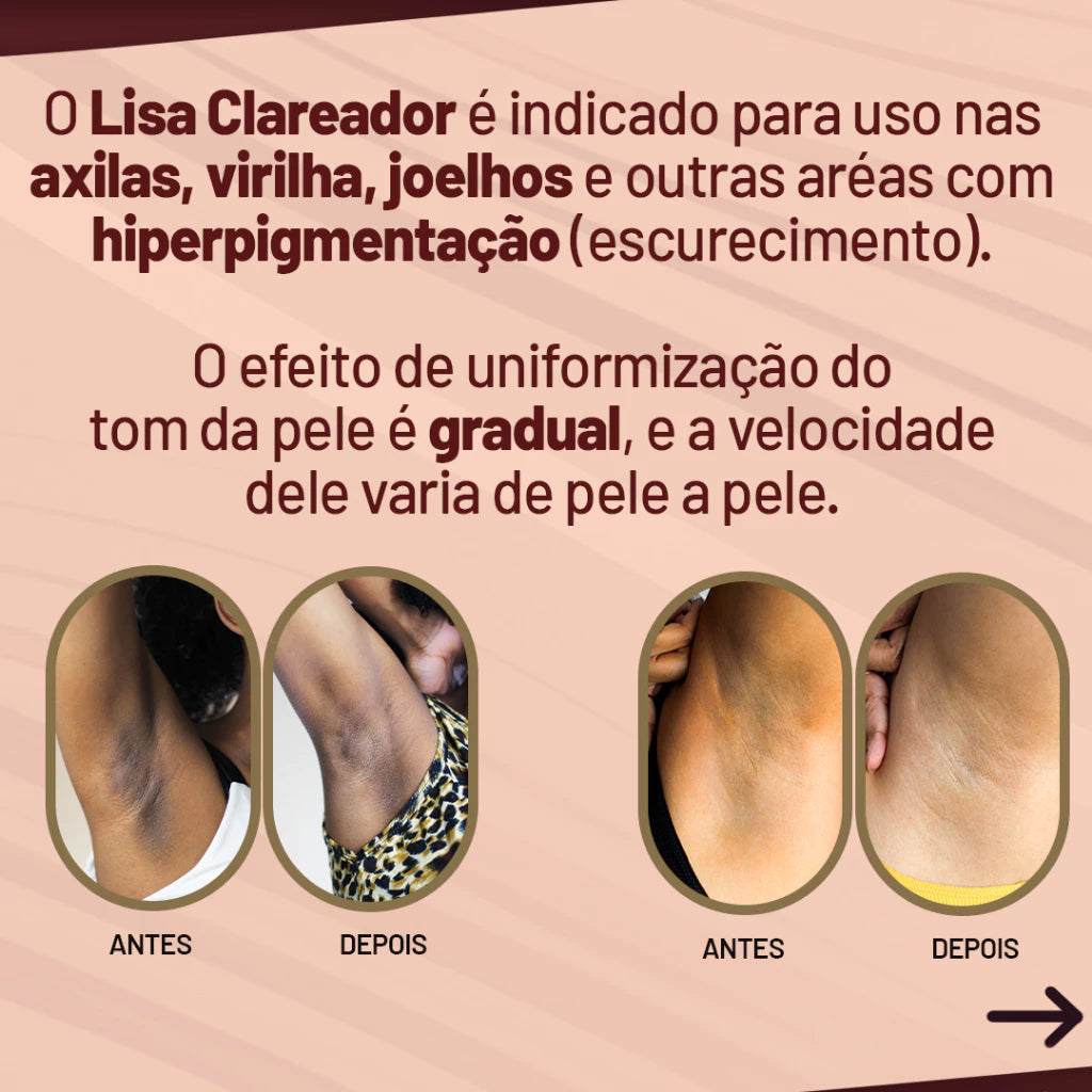 Creme Lisa Clareador de Axilas e Virilhas - Sellve