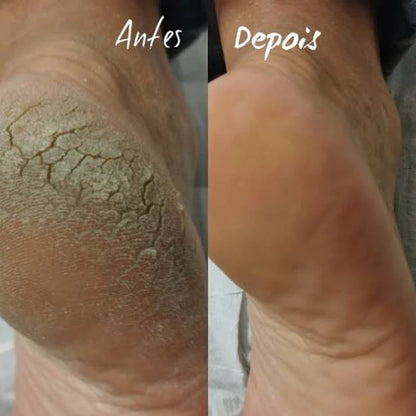 Creme Hidratante para os Pés DermoPés™ - Sellve