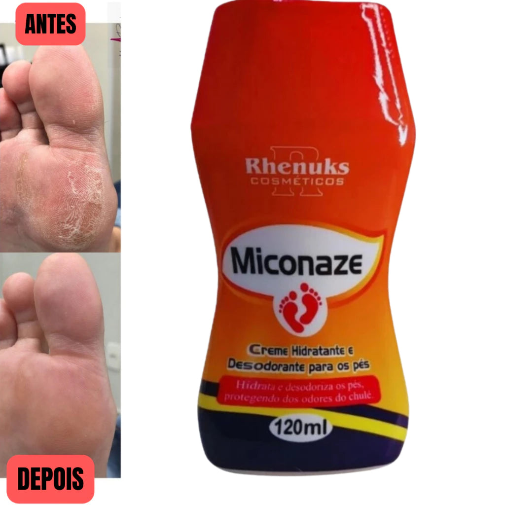 Creme Miconaze Hidratante e Desodorante Para os Pés e Anti-Micose - Sellve